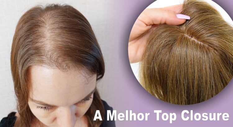 A melhor Top Closure para Alopecia