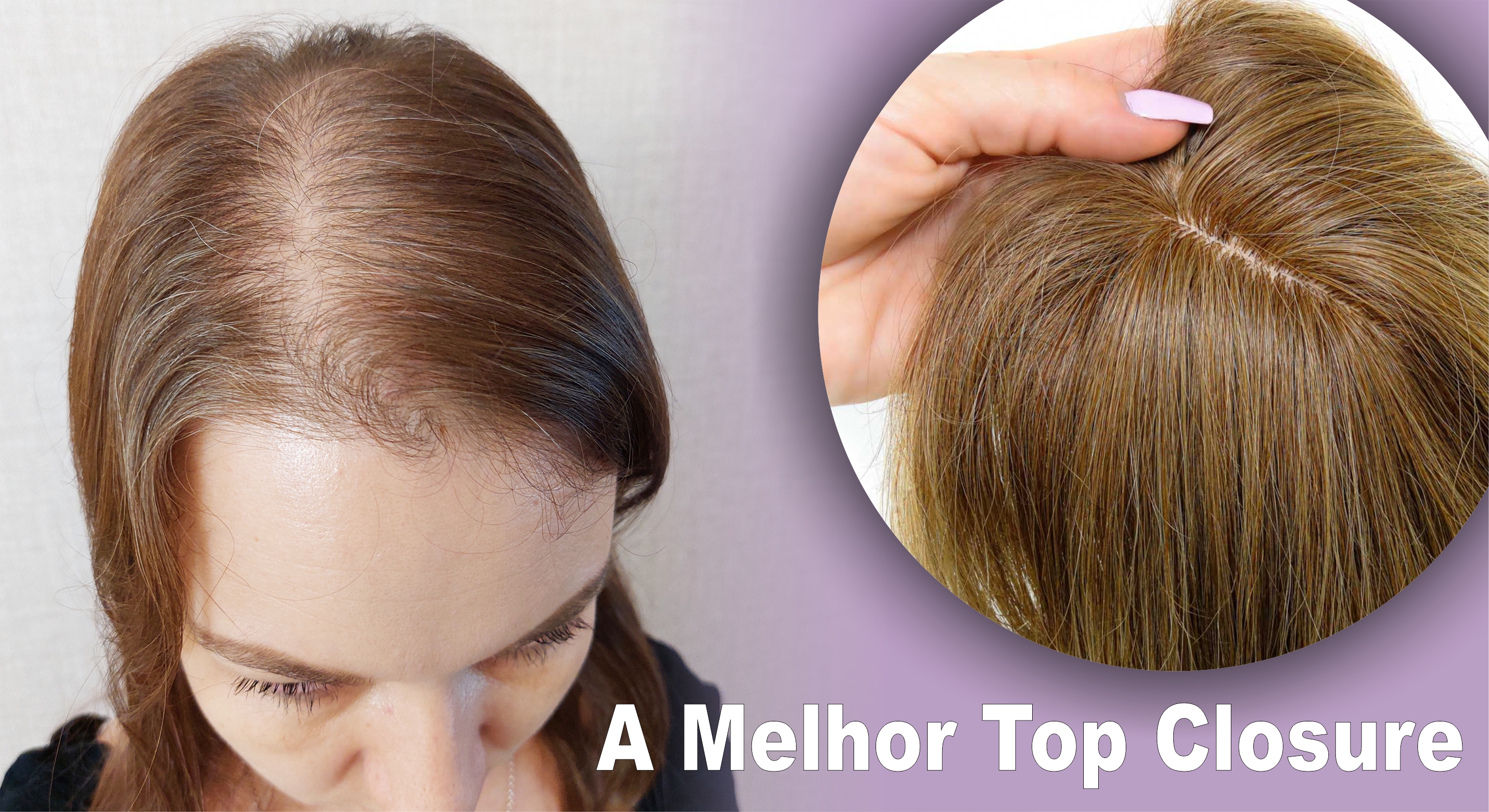 Qual a Melhor Top Closure - Topo de Cabeça? - Dicas Mega Hair