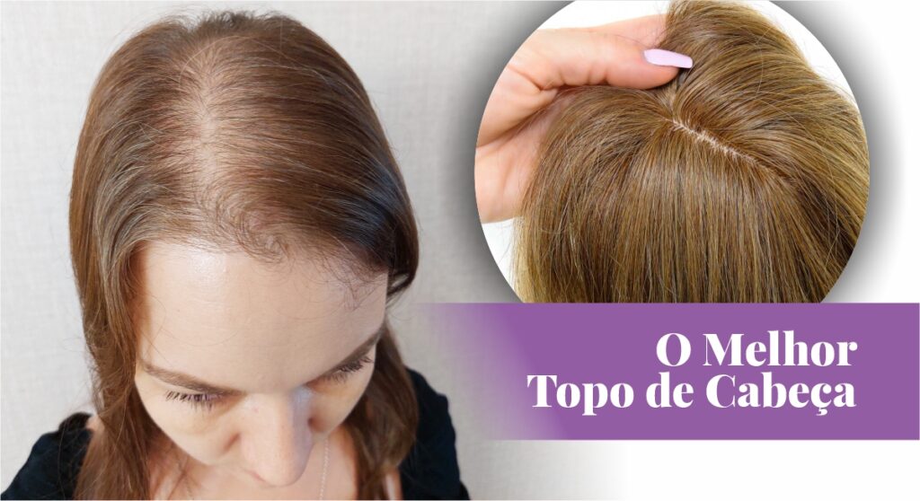 Uma imagem composta. No lado esquerdo, o topo da cabeça de uma mulher com cabelos loiro médio finos, revelando o couro cabeludo e algumas raízes grisalhas. No lado direito, sobreposto em um círculo, uma mão feminina segura um aplique capilar (topo de cabeça) de cabelos loiro médio e cheios, com uma repartição natural imitando o couro cabeludo. Na parte inferior direita, o texto em português 'O Melhor Topo de Cabeça'.